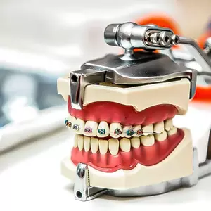 Нужно ли удалять зубы при неправильном прикусе? 
